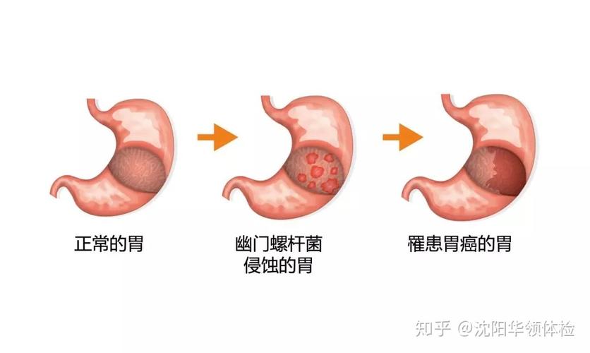澳门开奖结果+开奖记录表生肖和恋爱后莫名口臭胃痛与谈恋爱口臭